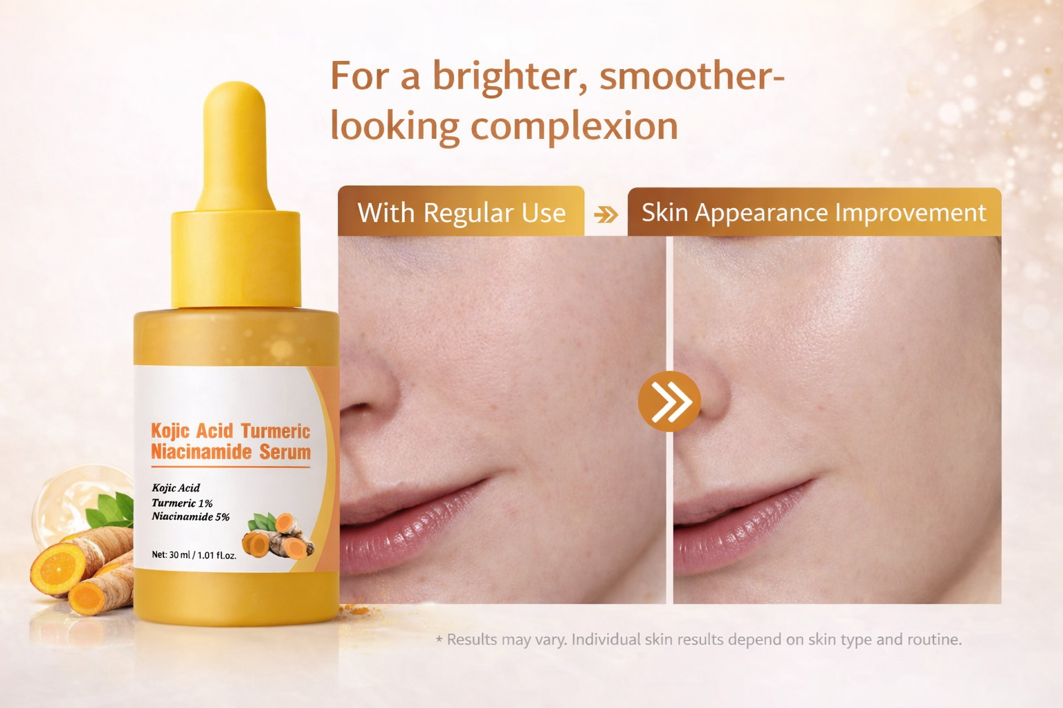 Luuminous Skin Serum – Niacinamide + Turmeric + Kojic Acid | Brightening, Soothing & Moistre Lock”
