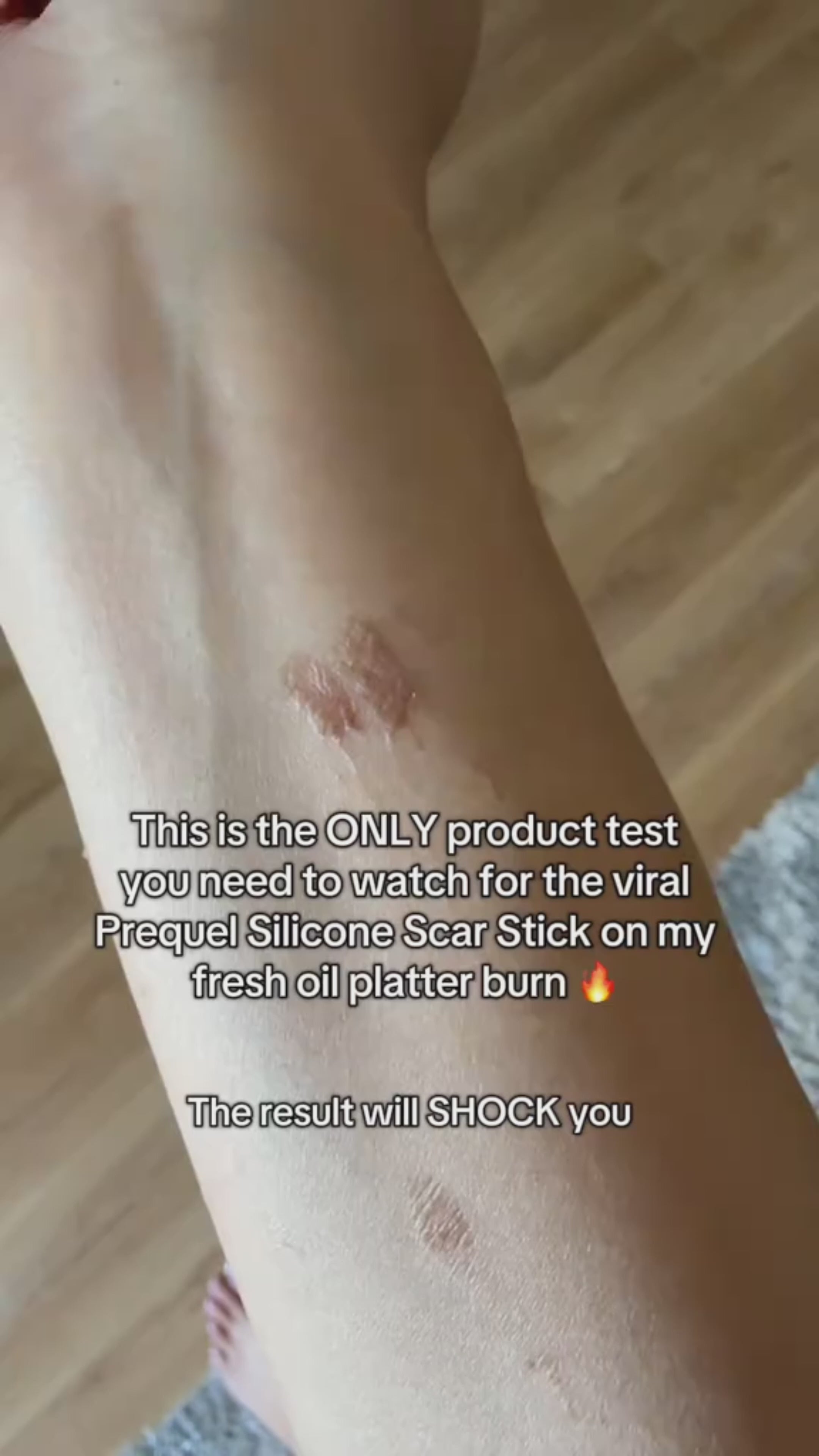 Silicon Scar Stick