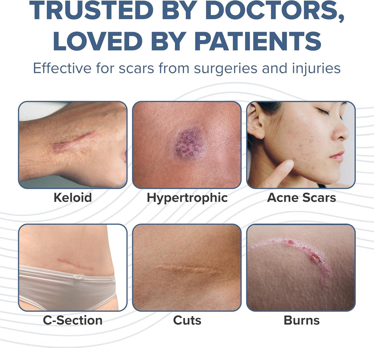 Silicon Scar Stick